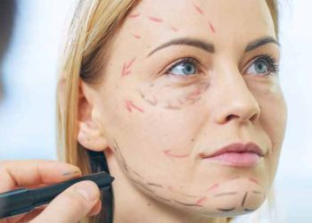 Everything You Need To Know About Facelift Surgery